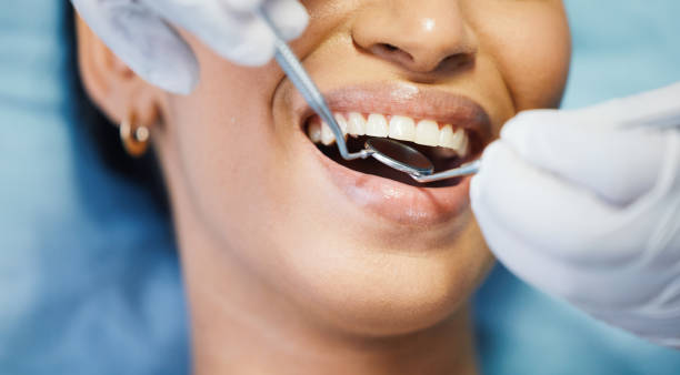Best Emergency Dental Care for Broken or Chipped Teeth in Lo, HI